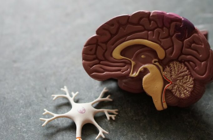 Plastico di un cervello. Encefalopatia TDP-43