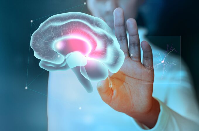 Immagine di un cervello con dietro un medico. Storia dell'Ictus